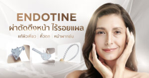 Endotine
