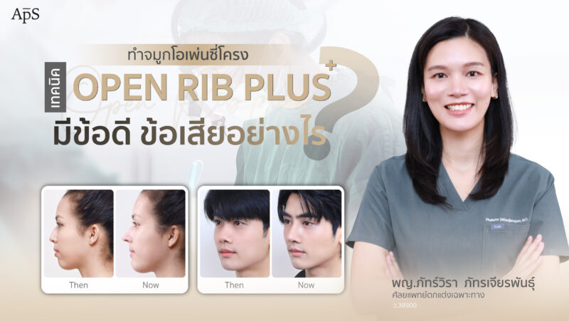 Open Rib Plus