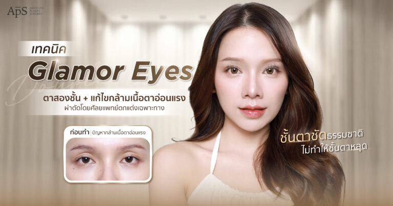 ภาวะกล้ามเนื้อตาอ่อนแรง ที่มาพร้อมกับอาการตาโหล แก้ได้ด้วยทำตาสองชั้น เทคนิค Glamor Eyes 5 ทำตาสองชั้นรักษาภาวะกล้ามเนื้อตาอ่อนแรง
