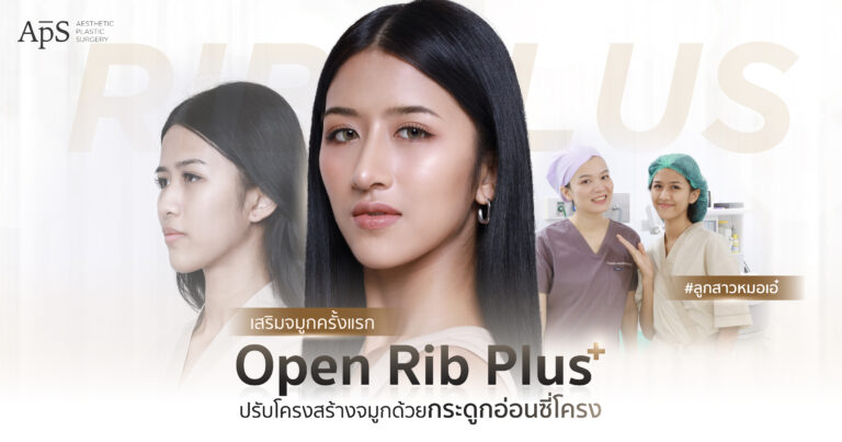 เสริมจมูก Open Rib Plus+ เนื้อจมูกน้อย มีฮัมพ์จมูกสูง ปลายจมูกบางแก้ได้ 8 เสริมจมูก Open Rib Plus+