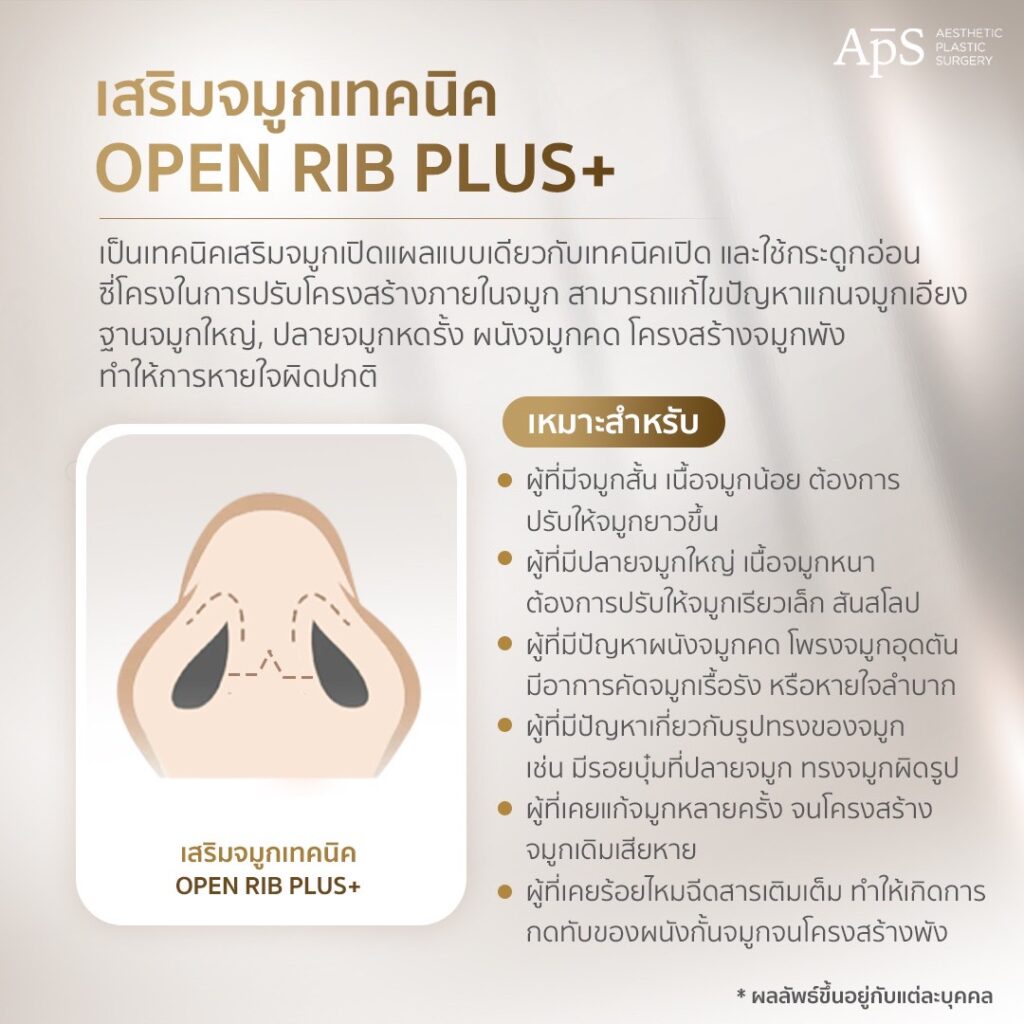 รวม 5 เทคนิคการเสริมจมูกที่ APS Clinic 6 เสริมจมูก