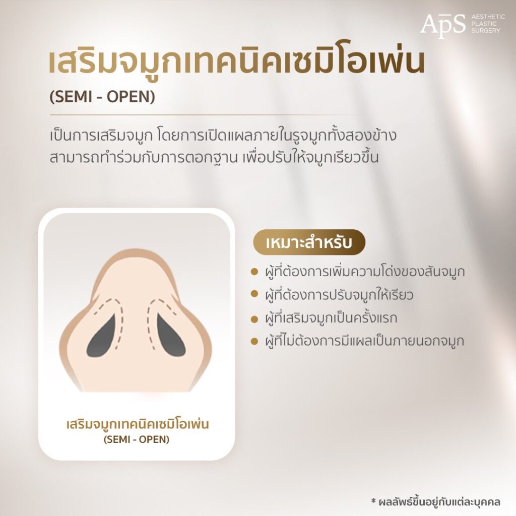 รวม 5 เทคนิคการเสริมจมูกที่ APS Clinic 3 เสริมจมูก