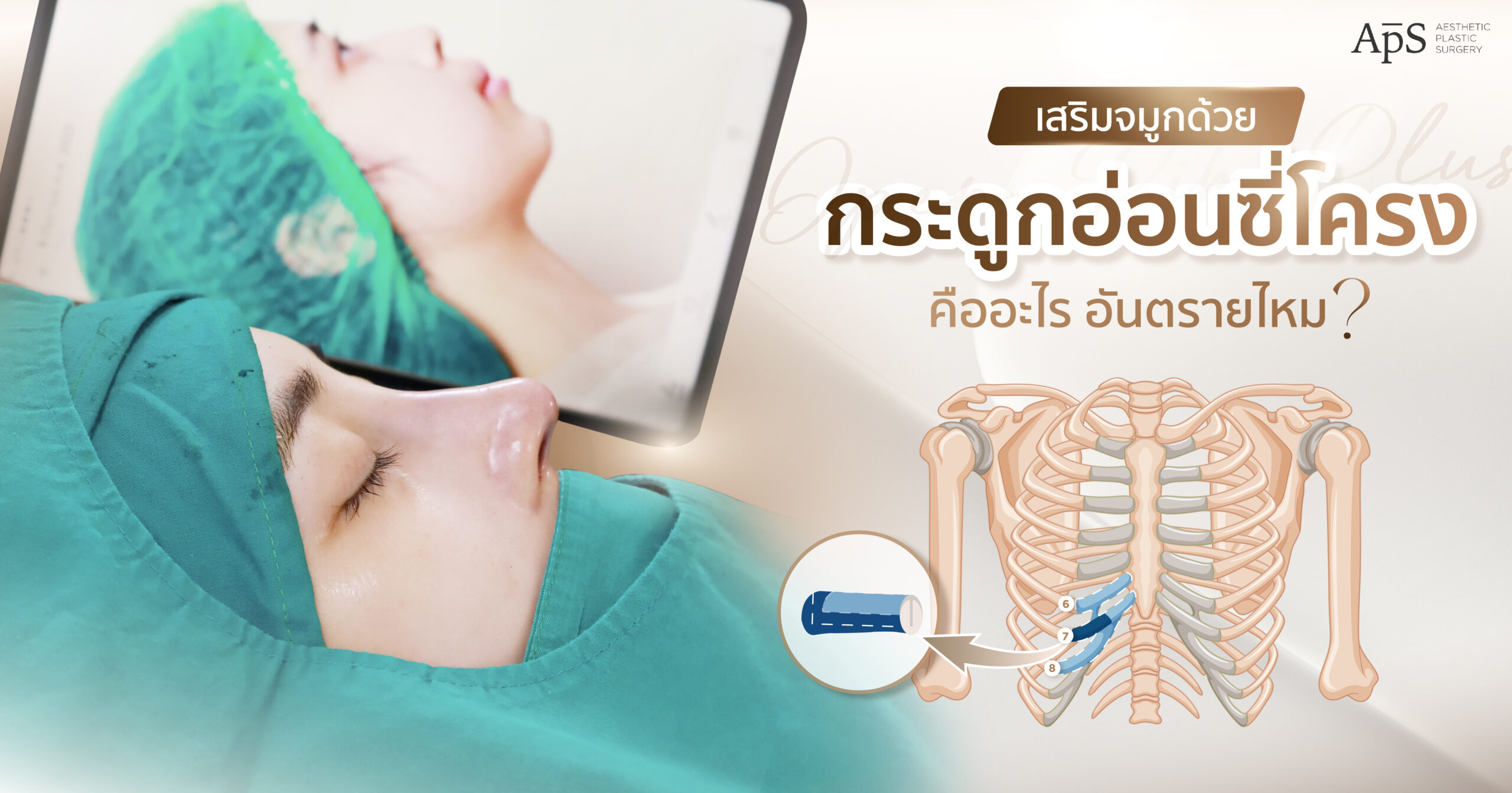 เสริมจมูกด้วยกระดูกอ่อนซี่โครงคืออะไร