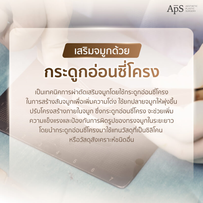 เสริมจมูกด้วยกระดูกอ่อนซี่โครง