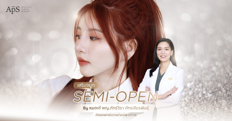 เสริมจมูก Semi Open ฉบับสาวเนื้อจมูกเยอะ 2 เสริมจมูก Semi Open