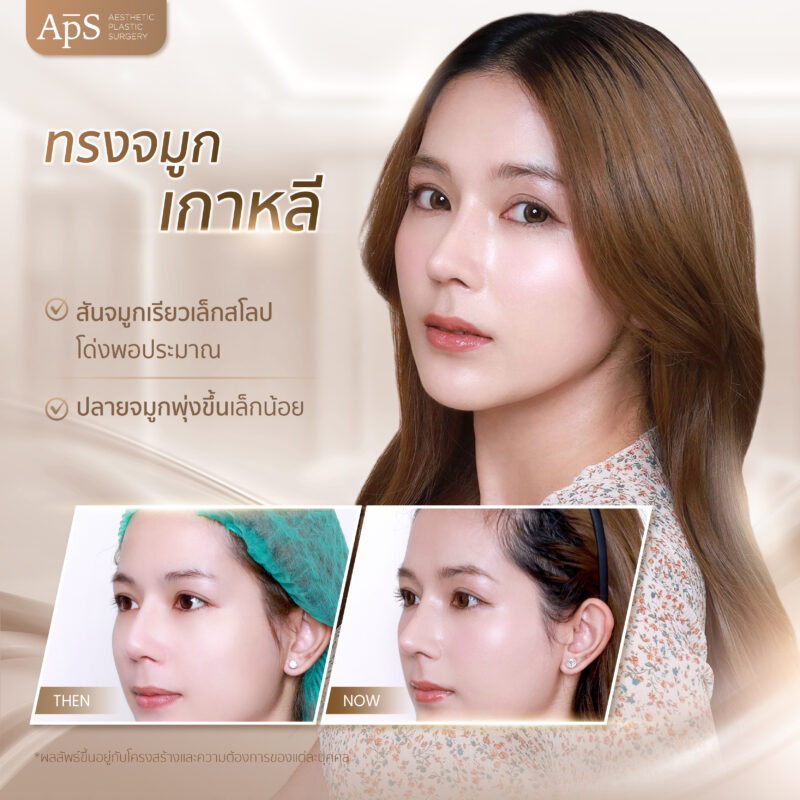 ทรงจมูกยอดนิยมปี 2025 เพิ่มความมั่นใจทุกมุมมอง 3 ทรงจมูกเกาหลี