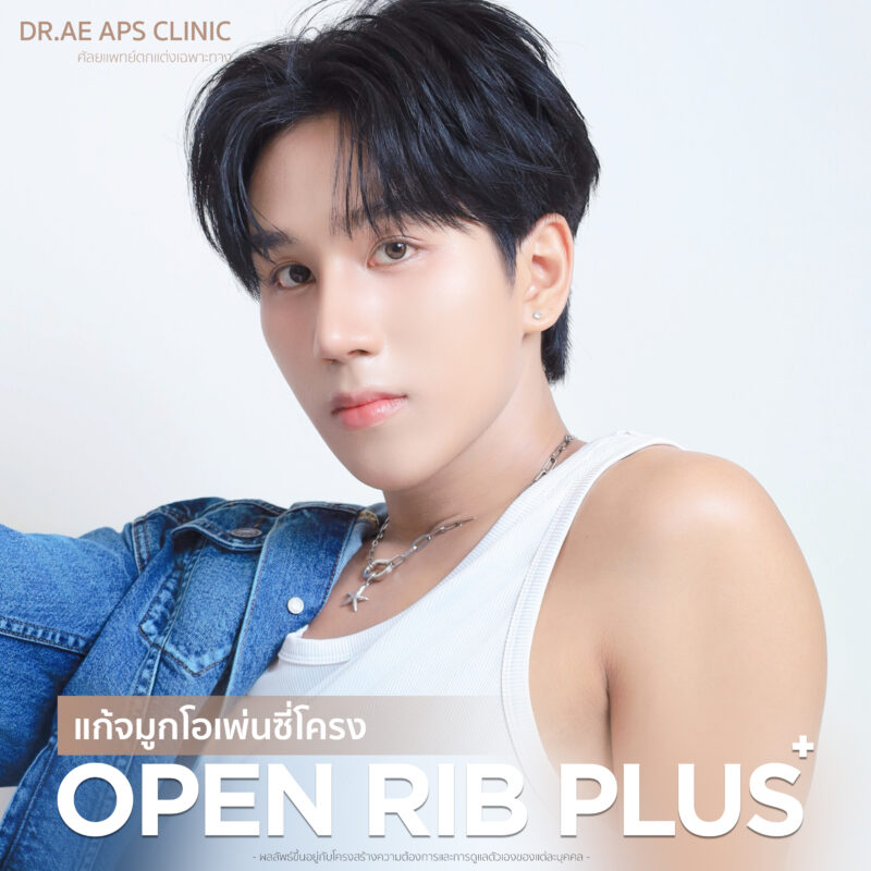 แก้จมูก open rib plus+