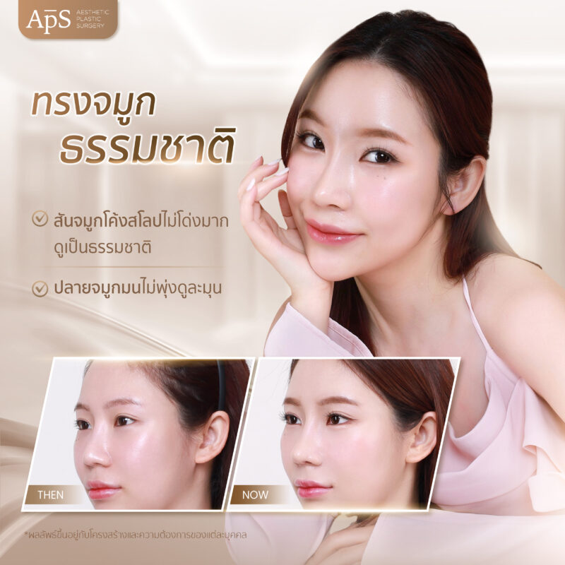 ทรงจมูกยอดนิยมปี 2025 เพิ่มความมั่นใจทุกมุมมอง 2 ทรงจมูกธรรมชาติ