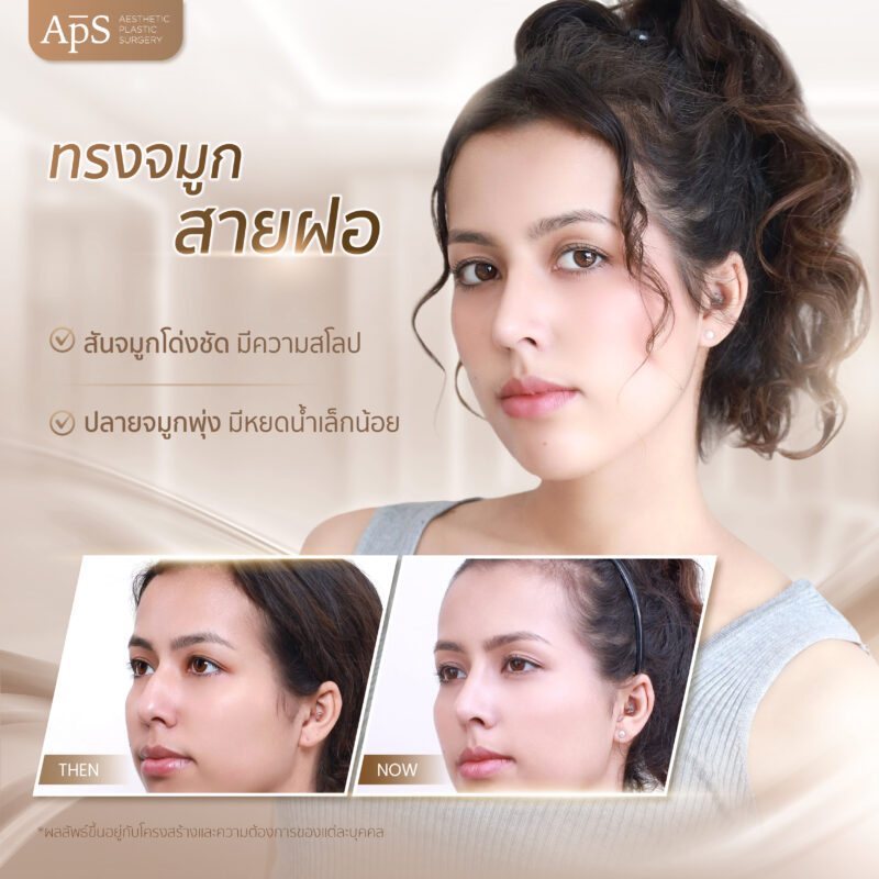 ทรงจมูกยอดนิยมปี 2025 เพิ่มความมั่นใจทุกมุมมอง 6 ทรงจมูกสายฝอ