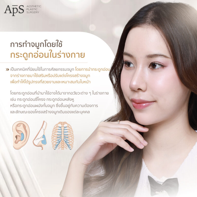 การเสริมจมูกด้วยกระดูกอ่อน 3 ชนิดที่ได้จากร่างกาย ปลอดภัย ไม่แพ้ 2 การทำจมูกโดยใช้กระดูกอ่อนในร่างกาย