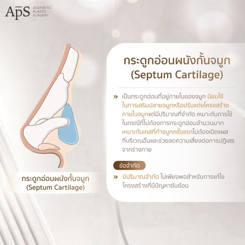 การเสริมจมูกด้วยกระดูกอ่อน 3 ชนิดที่ได้จากร่างกาย ปลอดภัย ไม่แพ้ 4 กระดูกอ่อนผนังกั้นจมูก (Septum Cartilage)
