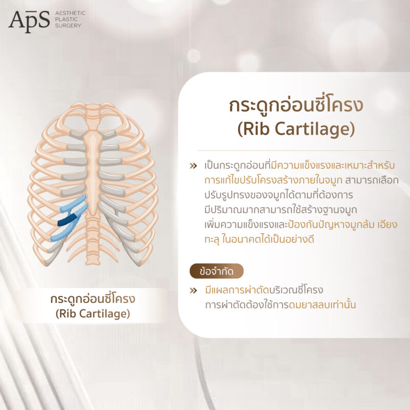 การเสริมจมูกด้วยกระดูกอ่อน 3 ชนิดที่ได้จากร่างกาย ปลอดภัย ไม่แพ้ 5 กระดูกอ่อนซี่โครง (Rib Cartilage)