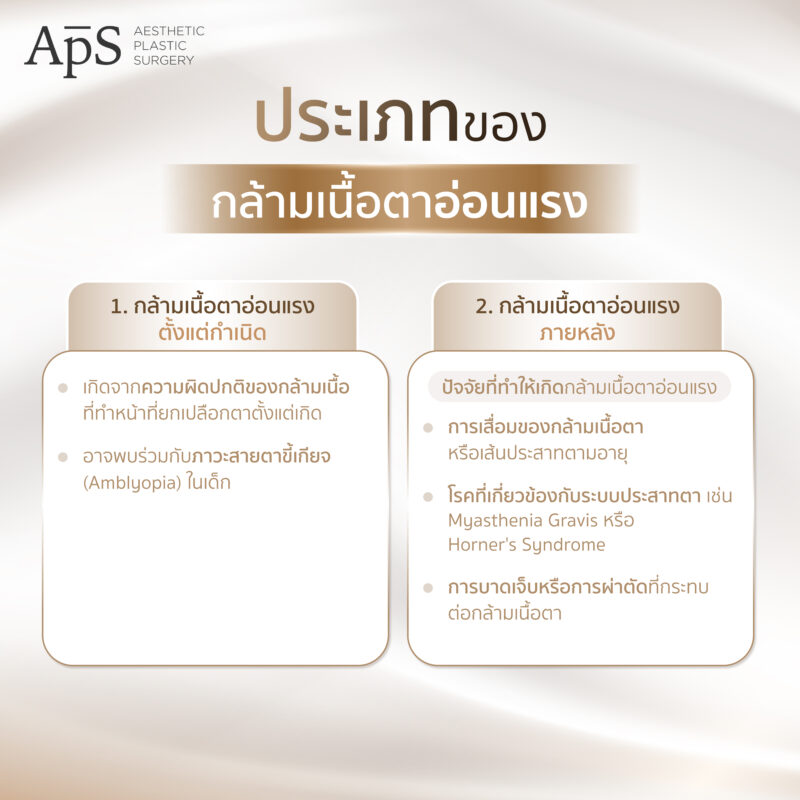 กล้ามเนื้อตาอ่อนแรงคืออะไร (Ptosis) สาเหตุเกิดจากอะไร อันตรายไหม มีวิธีการรักษาแบบไหนบ้าง 4 ประเภทของกล้ามเนื้อตาอ่อนแรง