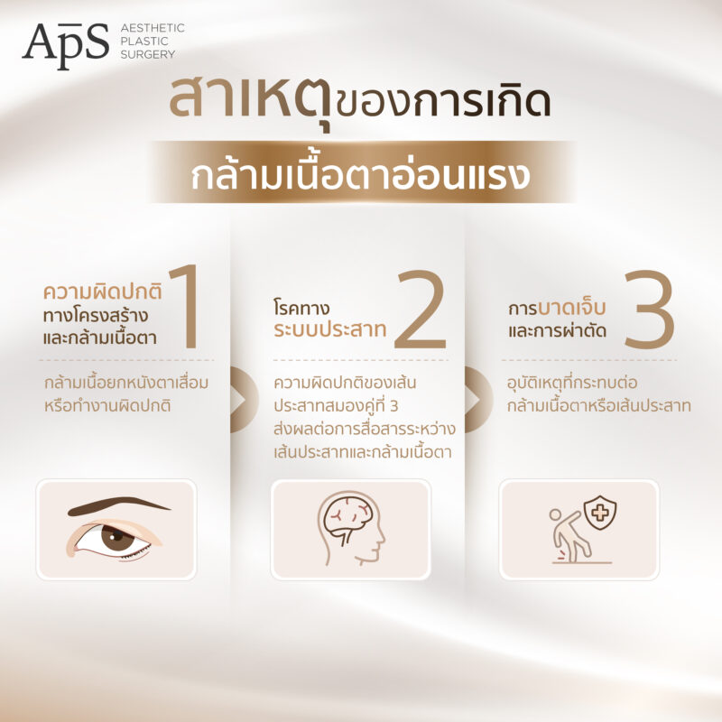 กล้ามเนื้อตาอ่อนแรงคืออะไร (Ptosis) สาเหตุเกิดจากอะไร อันตรายไหม มีวิธีการรักษาแบบไหนบ้าง 3 สาเหตุของการเกิดกล้ามเนื้อตาอ่อนแรง