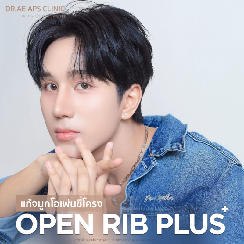 แก้จมูก open rib plus+