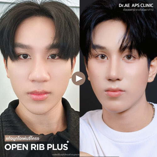 รีวิว Open Rib Plus+