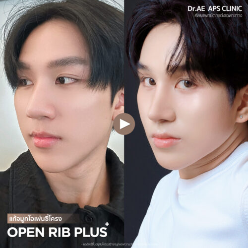 รีวิว Open Rib Plus+