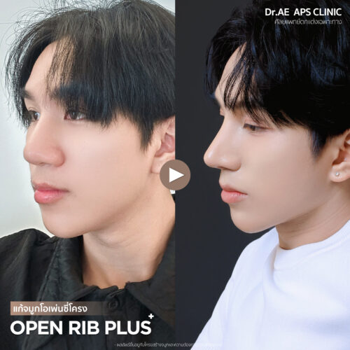 รีวิว Open Rib Plus+