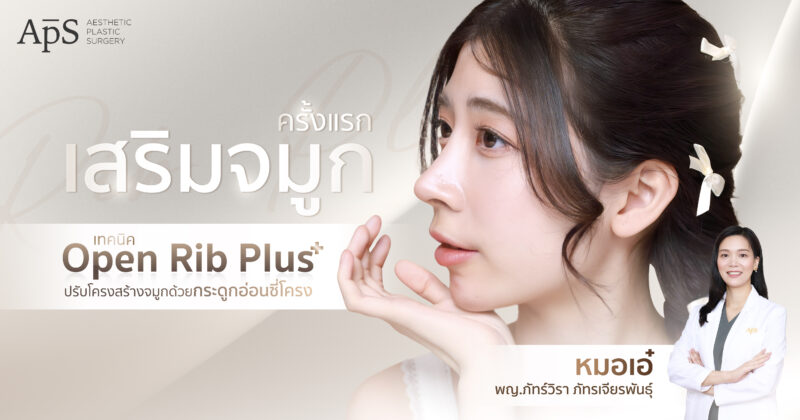 เสริมจมูก Open Rib Plus