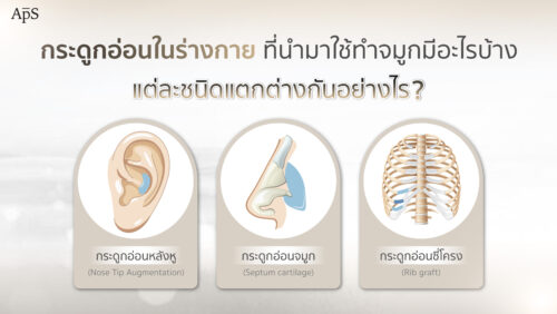 กระดูกอ่อนในร่างกาย