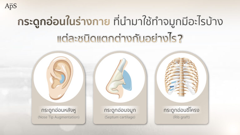 กระดูกอ่อนในร่างกาย