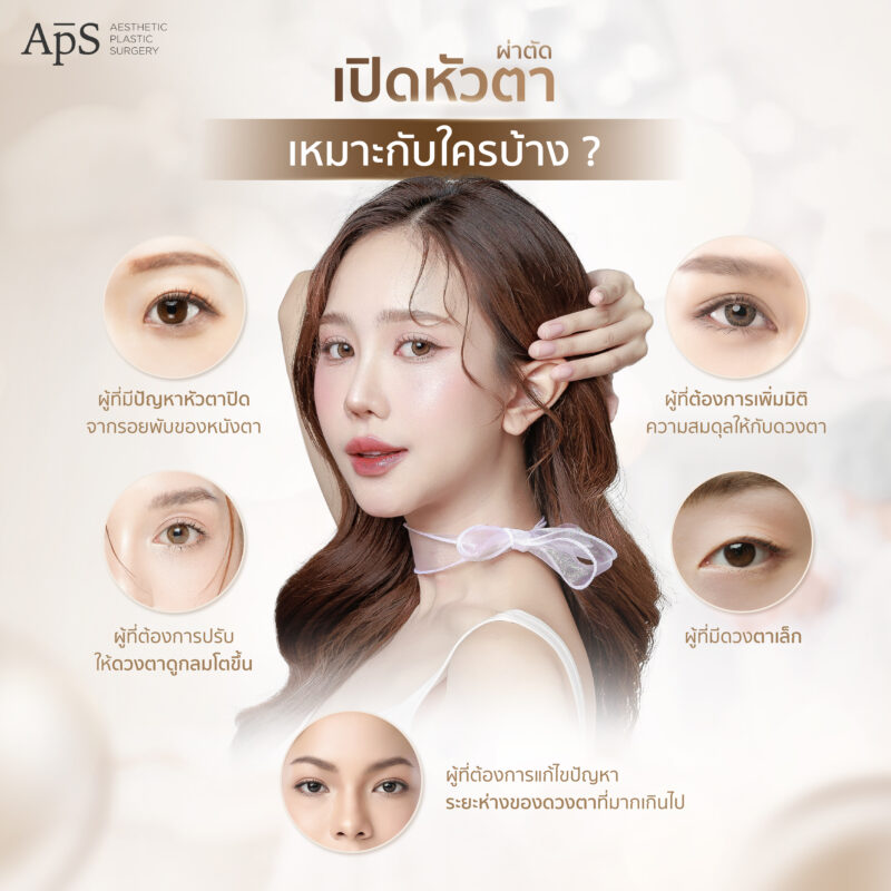 ผ่าตัดศัลยกรรมเปิดหัวตาเหมาะกับใครบ้าง