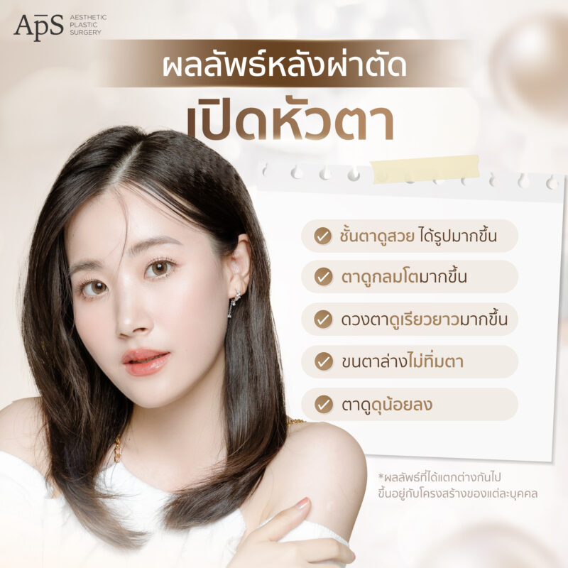 ผลลัพธ์หลังการผ่าตัดศัลยกรรมเปิดหัวตา