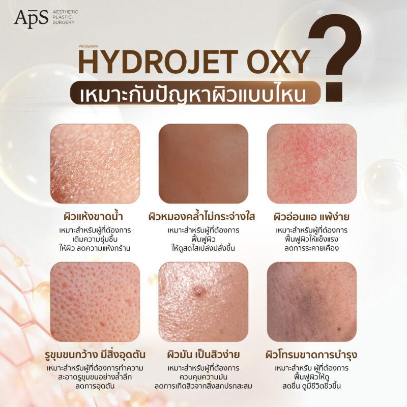 โปรแกรม Hydrojet Oxy เหมาะกับใคร?