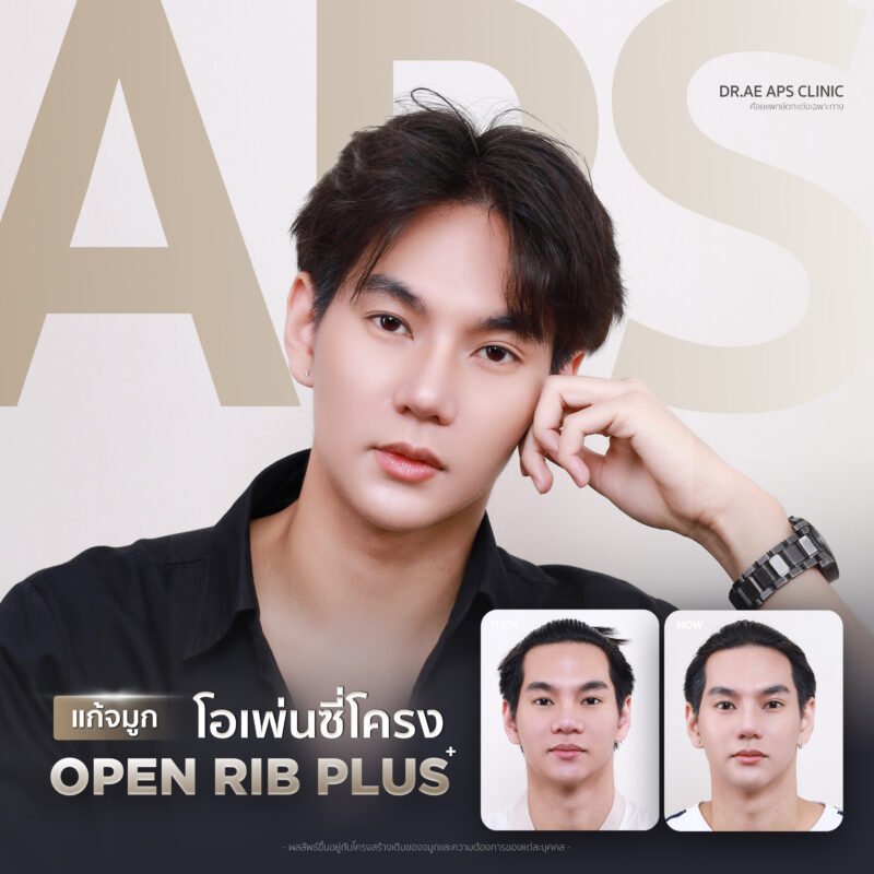 คุณโอม แก้จมูกเพิ่มความมั่นใจ