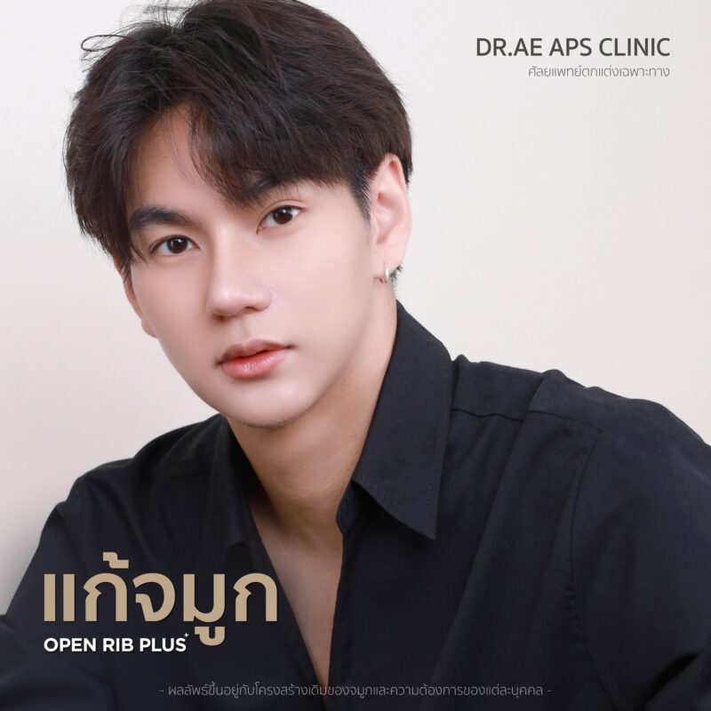 คุณโอม แก้จมูกเพิ่มความมั่นใจ