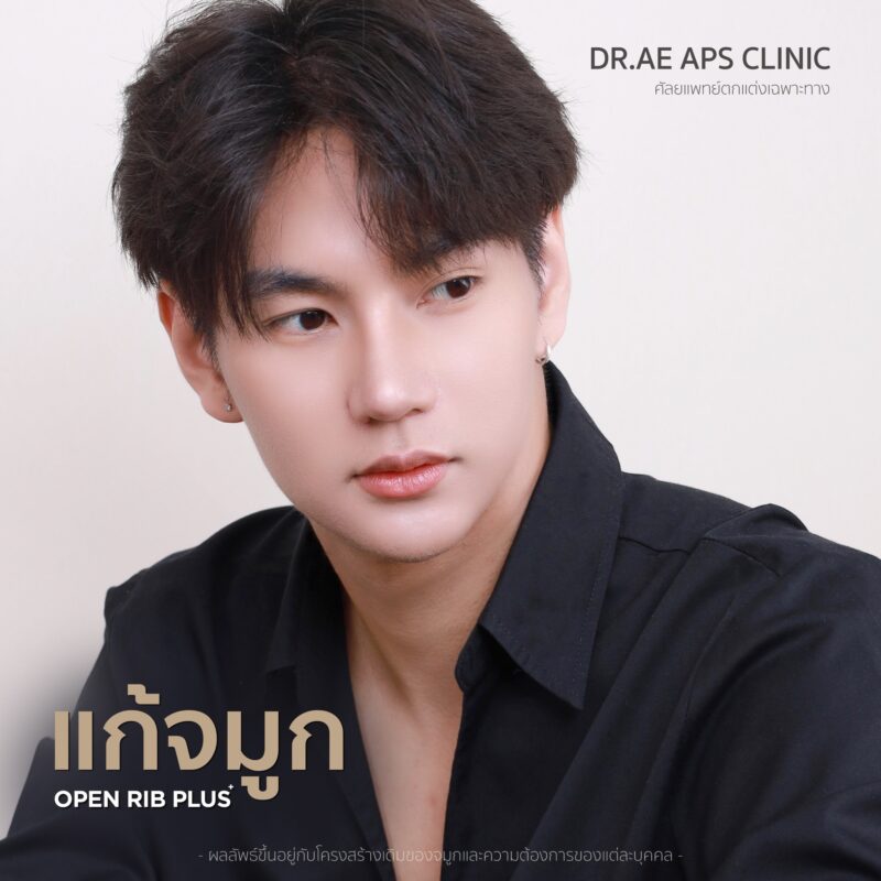 คุณโอม แก้จมูกเพิ่มความมั่นใจ