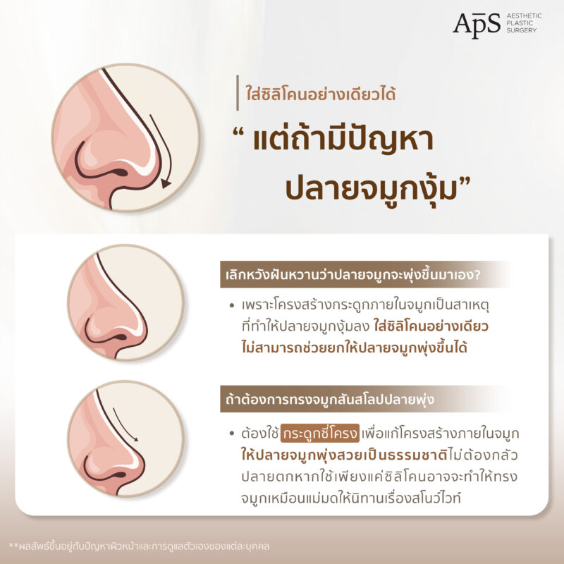 ผู้ที่มีปัญหาปลายจมูกงุ้ม