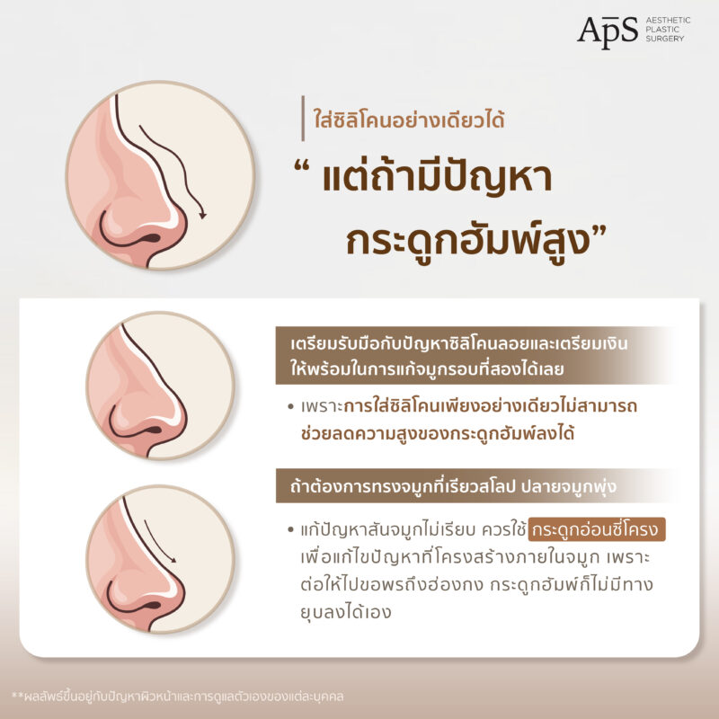 ผู้ที่มีปัญหากระดูกฮัมพ์สูง