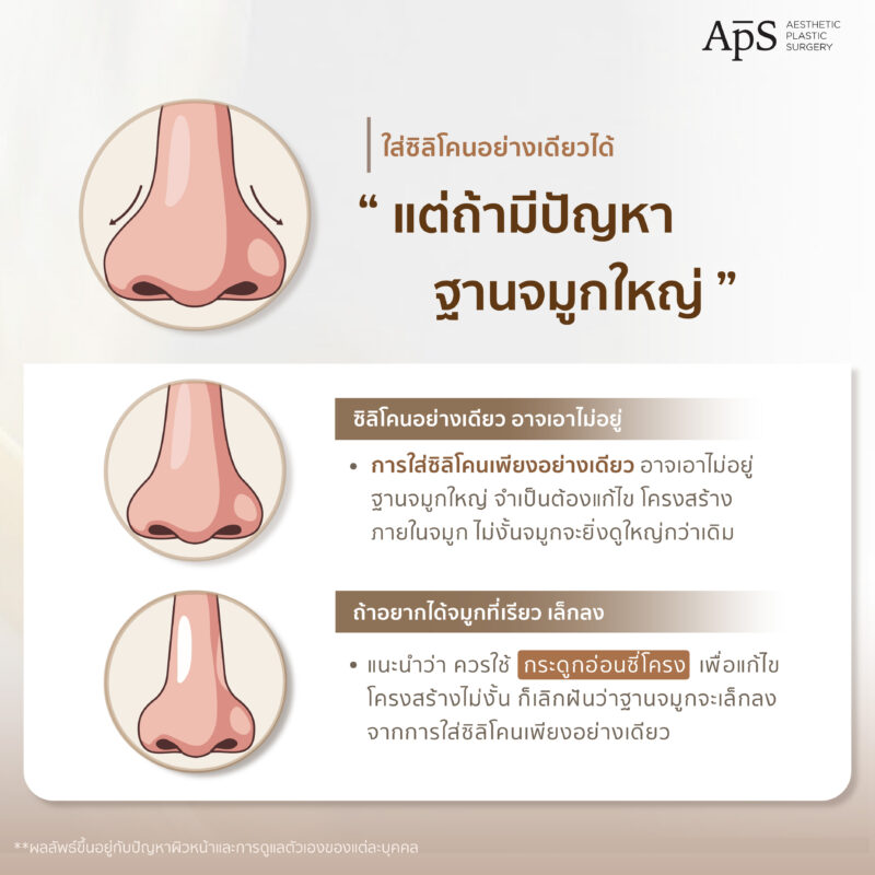 ผู้ที่มีปัญหาฐานจมูกใหญ่