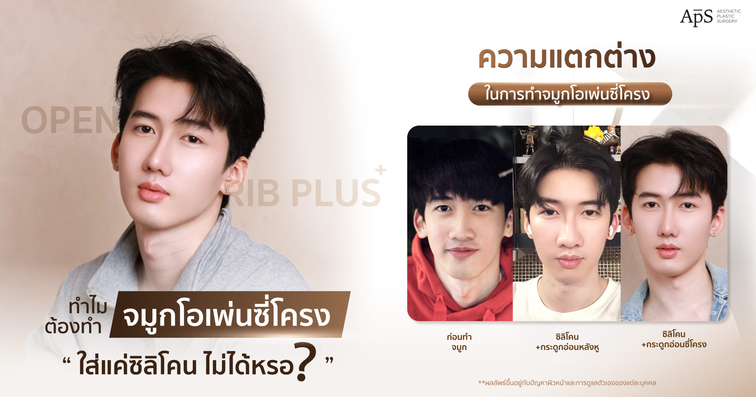 เสริมจมูกด้วยซิลิโคน