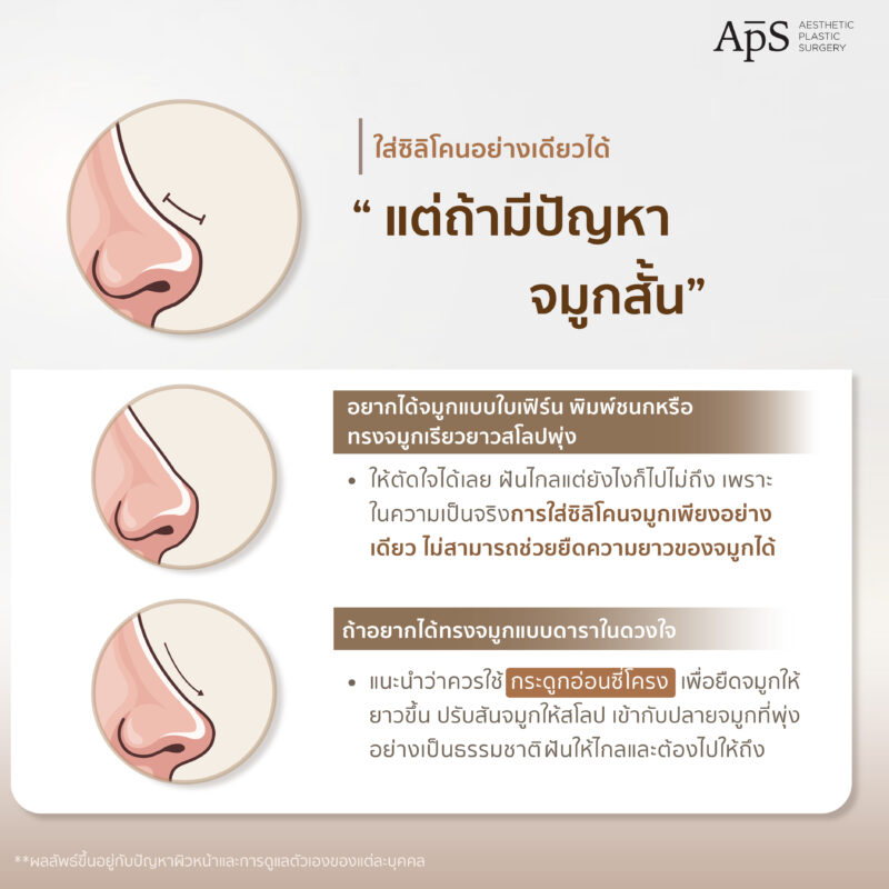 ผู้ที่มีปัญหาจมูกสั้น