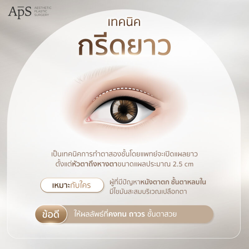 เทคนิคกรีดยาว