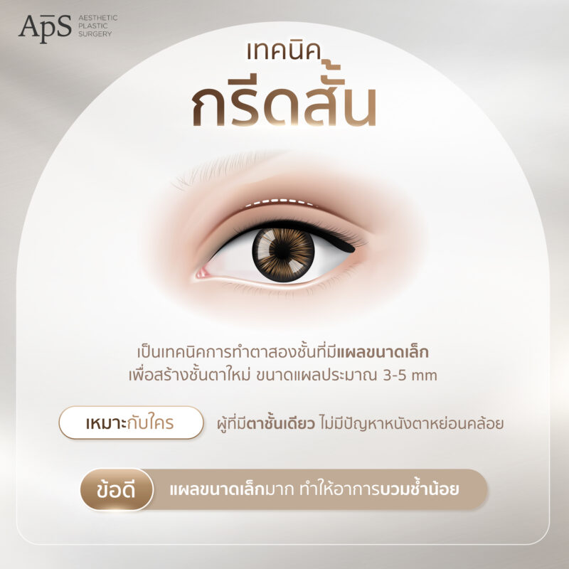 เทคนิคกรีดสั้น