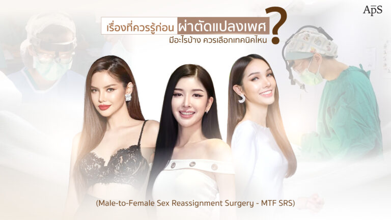 แปลงเพศ