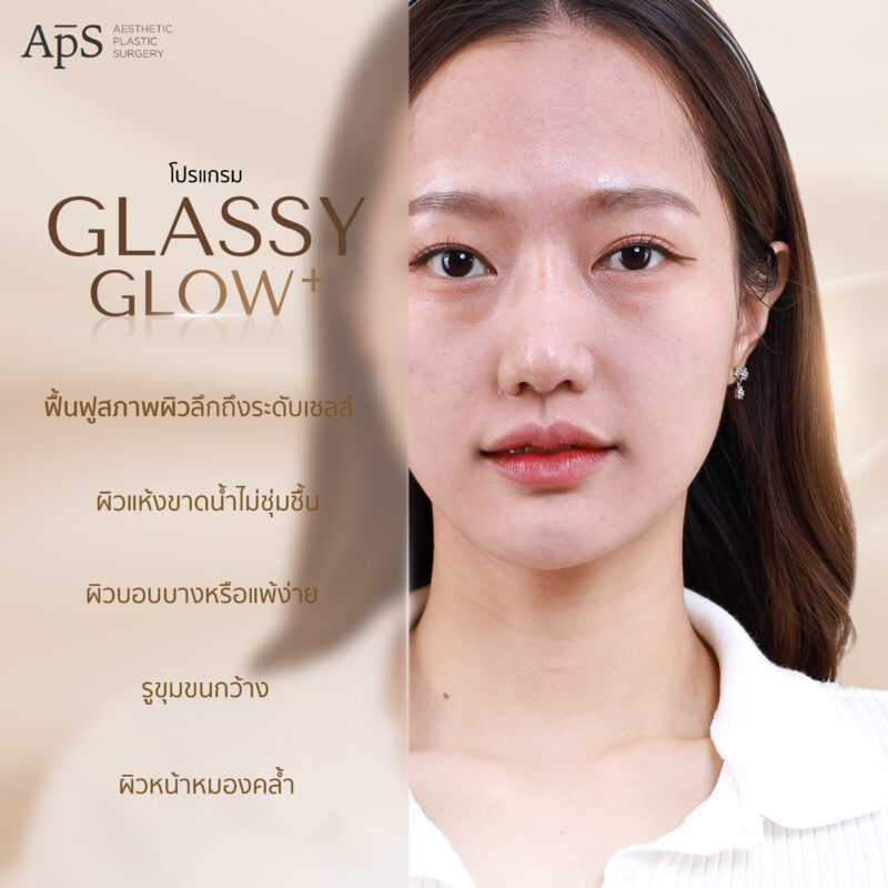 Glassy Glow คุณเอเชีย