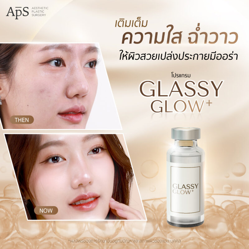 Glassy Glow คุณเอเชีย
