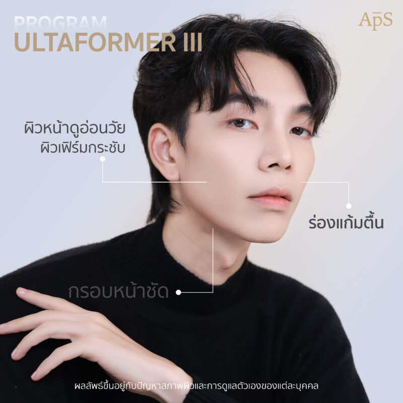 โปรแกรม Ultraformer  ยกกระชับปรับผิวเฟิร์ม ฉบับหนุ่มอินฟูล คุณนนน
