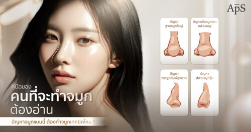 เทคนิคเสริมจมูกที่เหมาะกับการแก้ปัญหาจมูกแต่ละแบบ