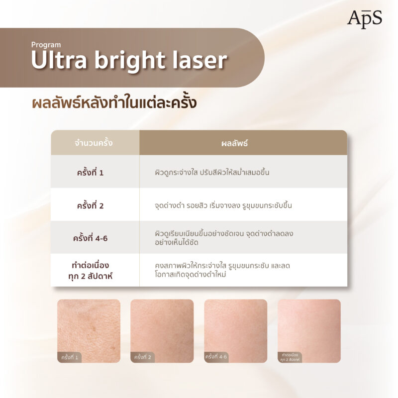 โปรแกรม Ultra Bright Laser เลเซอร์ผิวกระจ่างใส ผสาน 2 พลังเลเซอร์ยอดนิยมในหนึ่งเดียว 7 โปรแกรม Ultra Bright Laser เห็นผลอย่างไรในแต่ละครั้ง?