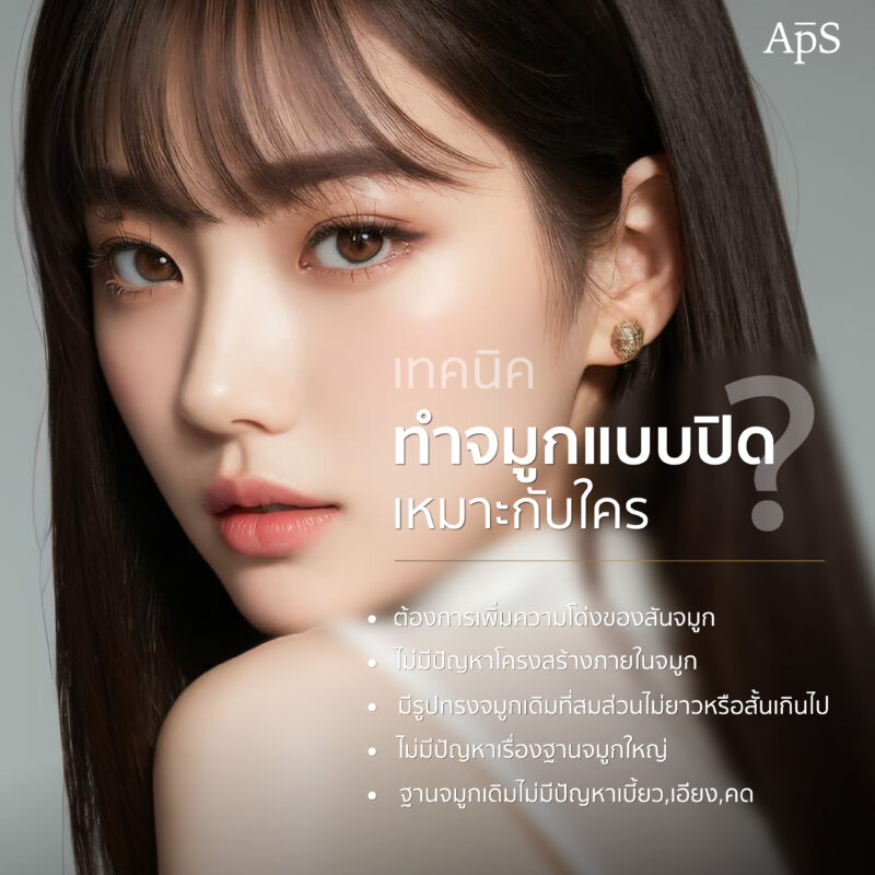 ทำจมูกเทคนิคปิด (Closed Rhinoplasty) เทคนิคเสริมจมูกยอดนิยมที่ทำกันมานาน 3 ใครเหมาะกับการทำจมูกเทคนิคปิด