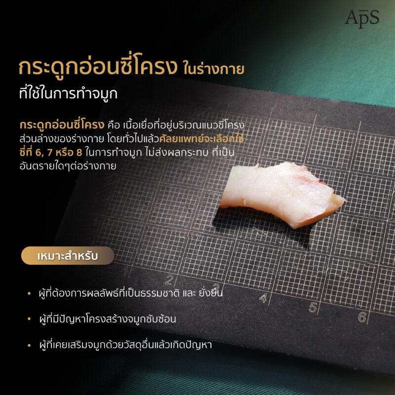 ข้อดีของการใช้กระดูกอ่อนซี่โครงตัวเองในการเสริมจมูก