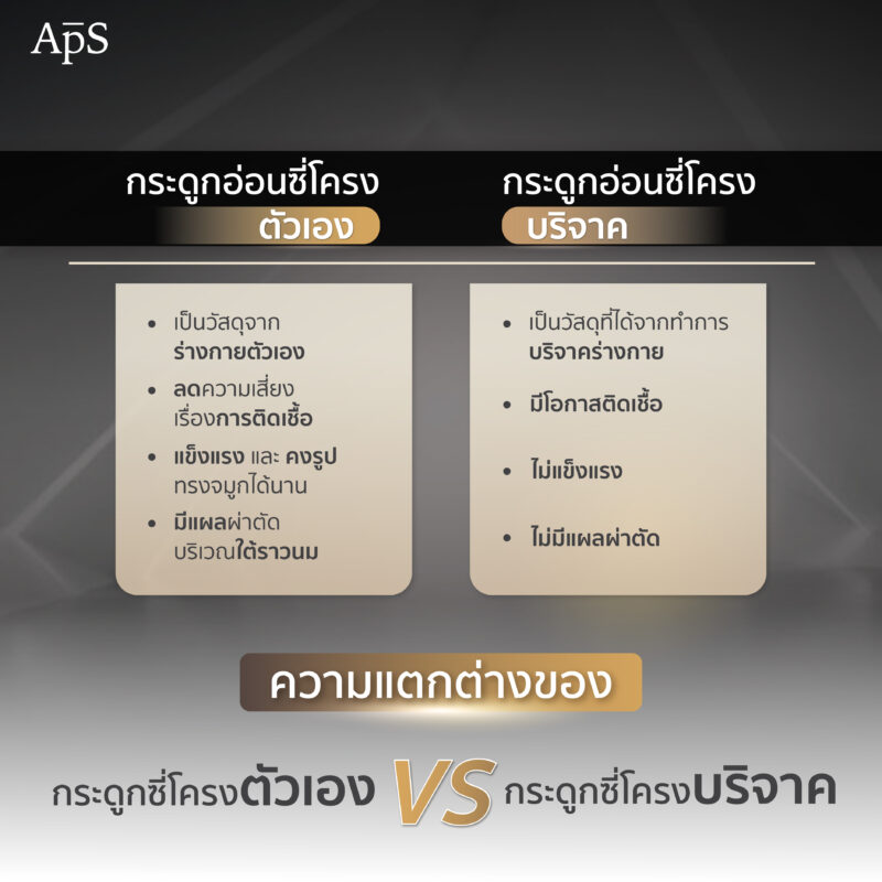  กระดูกอ่อนซี่โครงของตัวเอง VS กระดูกอ่อนซี่โครงบริจาค