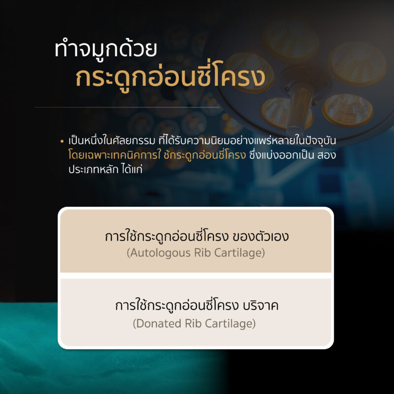 การทำจมูกด้วยกระดูกอ่อนซี่โครง