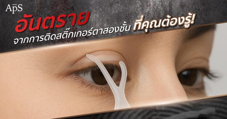 สติกเกอร์ทำตาสองชั้น