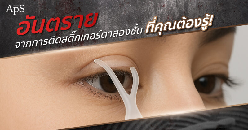 สติกเกอร์ทำตาสองชั้น